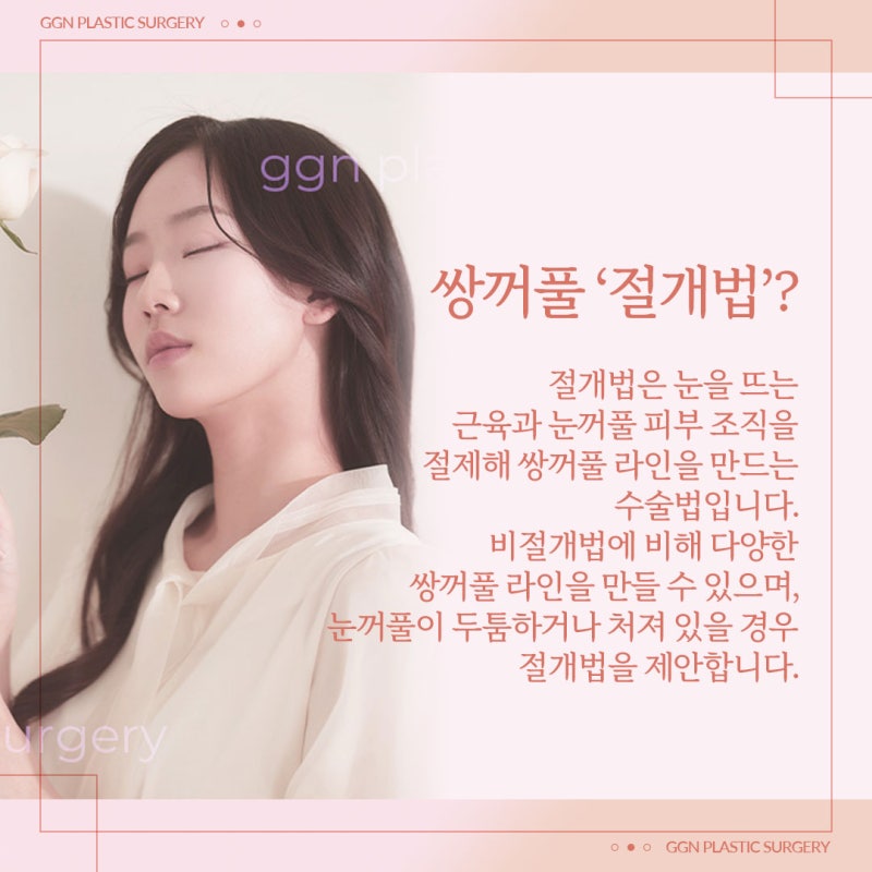 [강남 쌍꺼풀 수술]쌍꺼풀 절개법이란? 사진 2