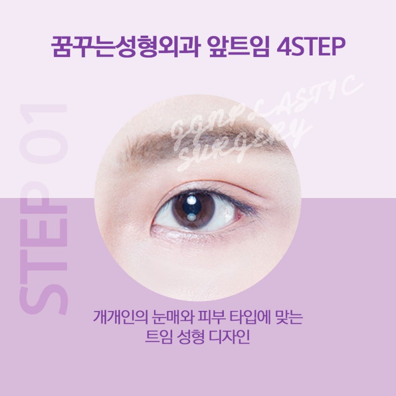 [강남 눈성형] 트임성형은 어떻게 진행될까요? 사진 4