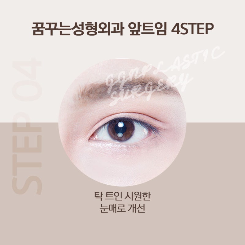 [강남 눈성형] 트임성형은 어떻게 진행될까요? 사진 7