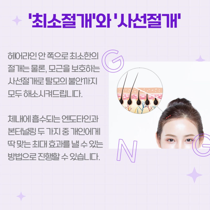 [강남 리프팅] 눈꺼풀부터 이마까지, 시원하게 끌어올리는 리프팅 수술 사진 5