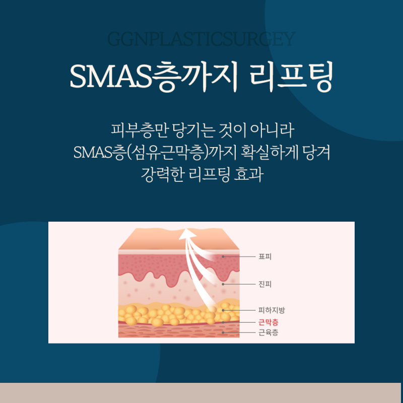 [강남 리프팅] 얼굴 처짐 개선에 강력한 효과를 주는 비법!