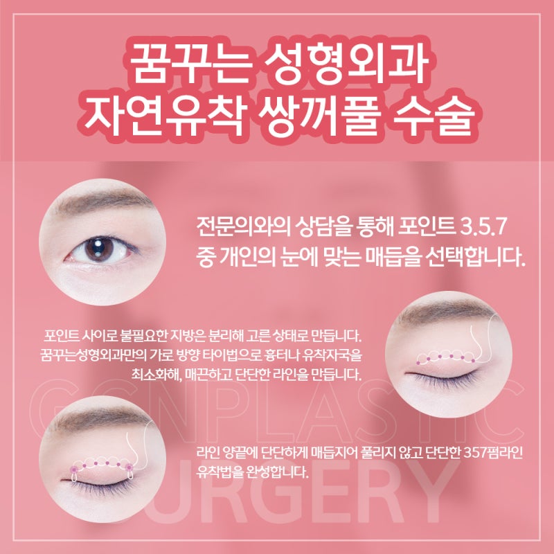 [강남 꿈꾸는성형외과] 예쁜 쌍꺼풀 모양과 조화로운 얼굴 사진 5