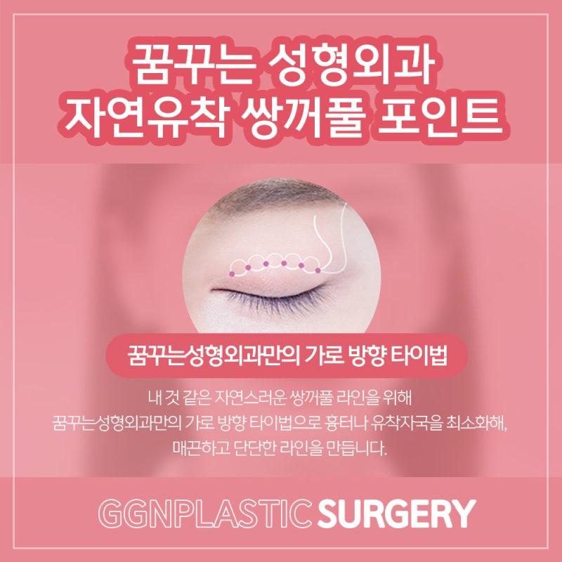 [강남 꿈꾸는성형외과] 예쁜 쌍꺼풀 모양과 조화로운 얼굴 사진 6