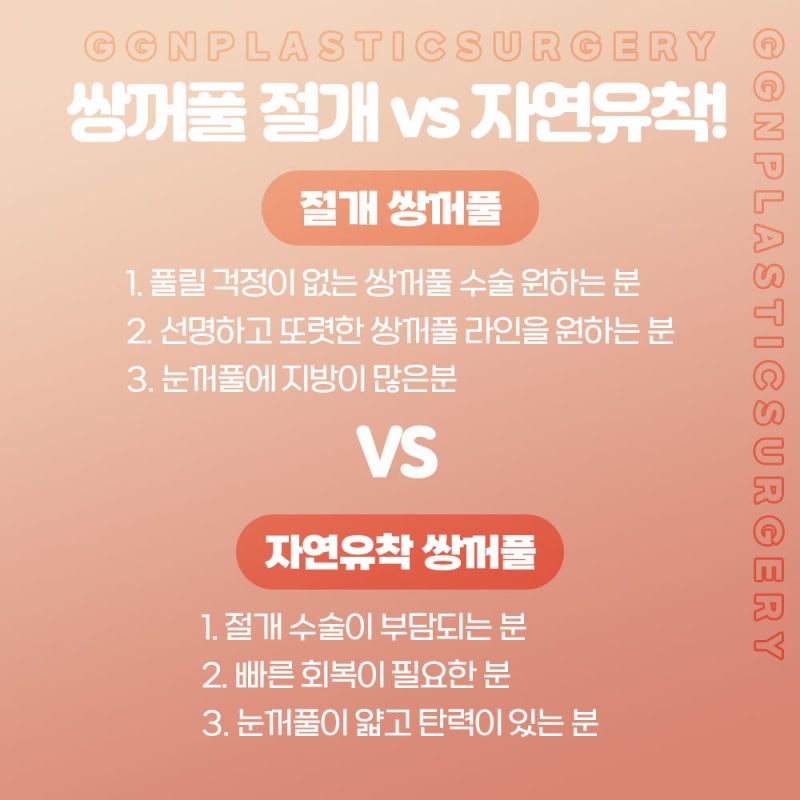 [강남 눈성형]쌍커풀과 눈매교정 어떤걸 해야할까? 사진 5