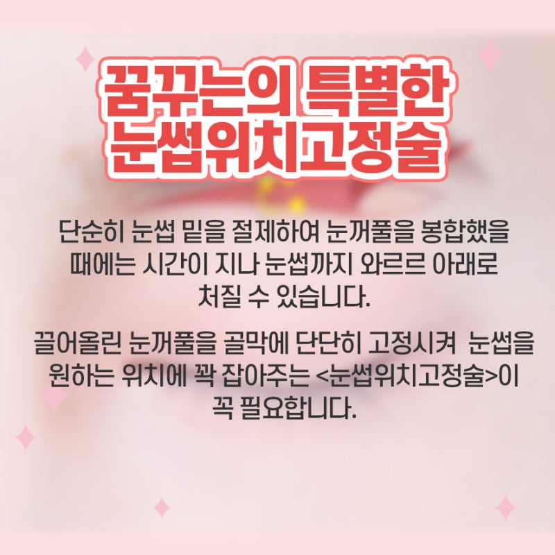 [강남 눈성형] 어리고 환한 눈매로 만들어주는 눈꺼풀 리프팅! 사진 3