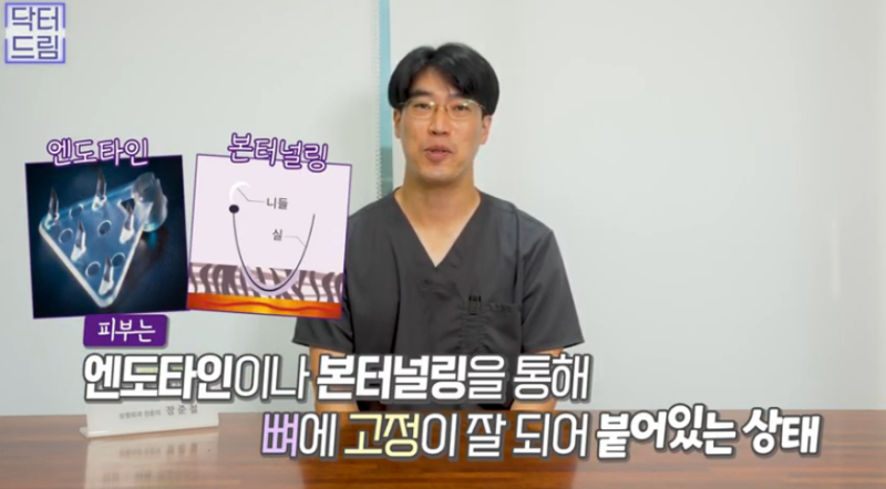 [강남 꿈꾸는 성형외과] 이마 거상술에 대한 모든 것! Q&A 1탄!