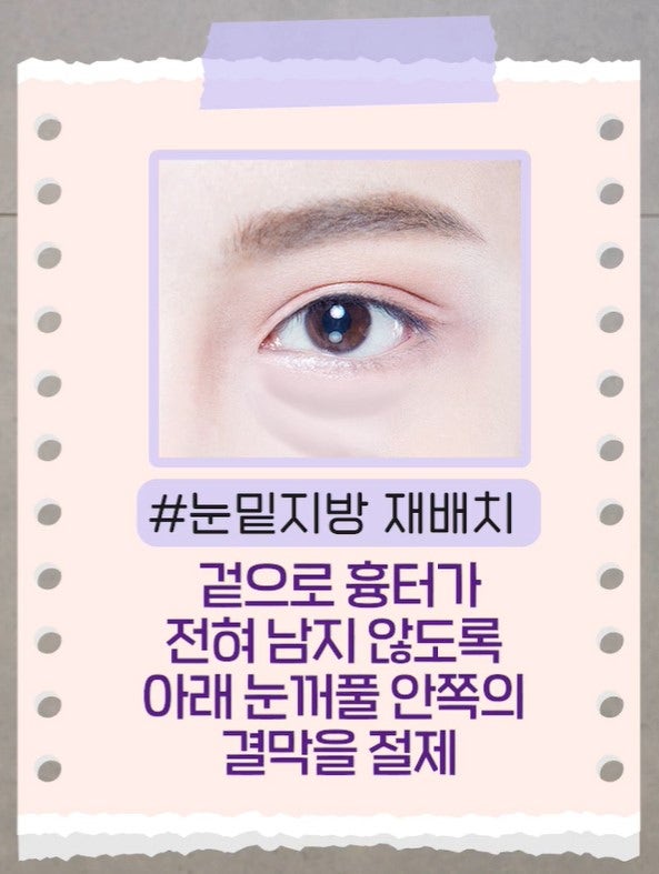 [강남 꿈꾸는 성형외과] 내 눈에 딱 맞는 눈 밑 지방제거! 사진 11
