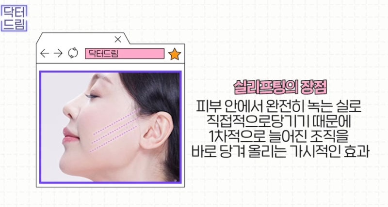 [강남꿈꾸는성형외과] 2023년 주목해야 할 성형 트렌드 TOP3! 사진 13