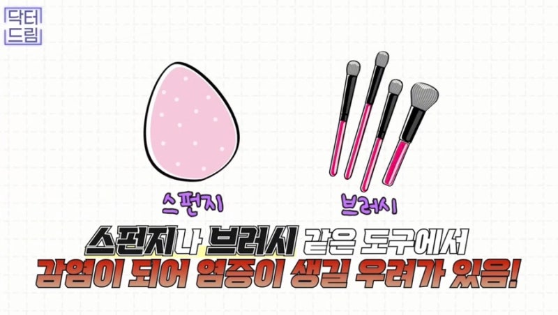 [강남꿈꾸는성형외과] 성형수술을 준비/진행하는 분들 주목! 성형 수술 후 주의사항! 사진 12