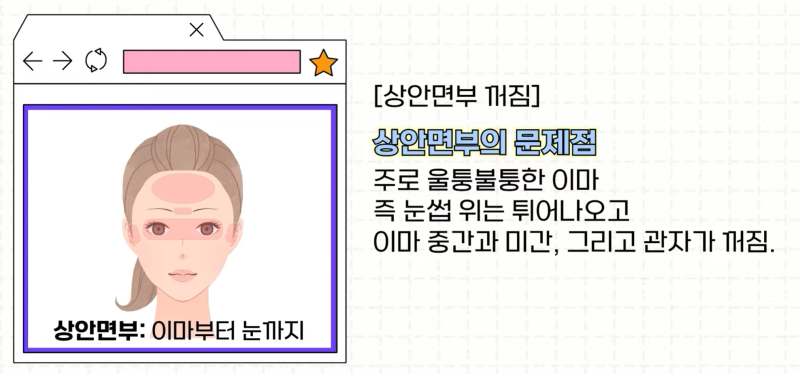 [강남 꿈꾸는성형외과] 족집게 과외 / 나에게 맞는 안티에이징 찾아드림!! 사진 5