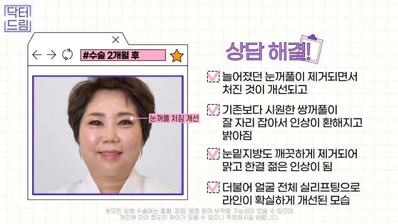 [강남꿈꾸는성형외과] 드림쌤 '중년 여성 성형' 상담 노트! 사진 15
