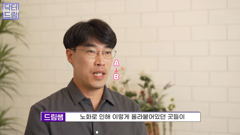 [강남꿈꾸는성형외과] 노화의 시작! 팔자주름 파헤치기 사진 8