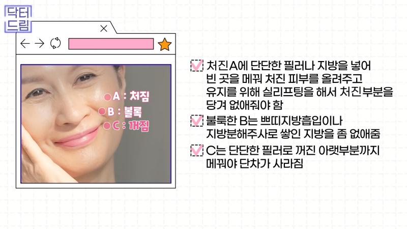 [강남꿈꾸는성형외과] 노화의 시작! 팔자주름 파헤치기 사진 15