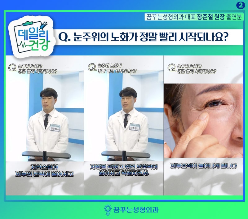 상안검 하안검 Q&A -데일리건강 꿈꾸는성형외과 장준철 원장님 방송출연분(1) 사진 2