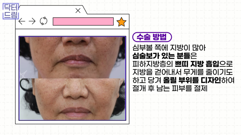 [강남꿈꾸는성형외과] 10년은 젊어 보이는 내 외모 관리법 2탄! 사진 4