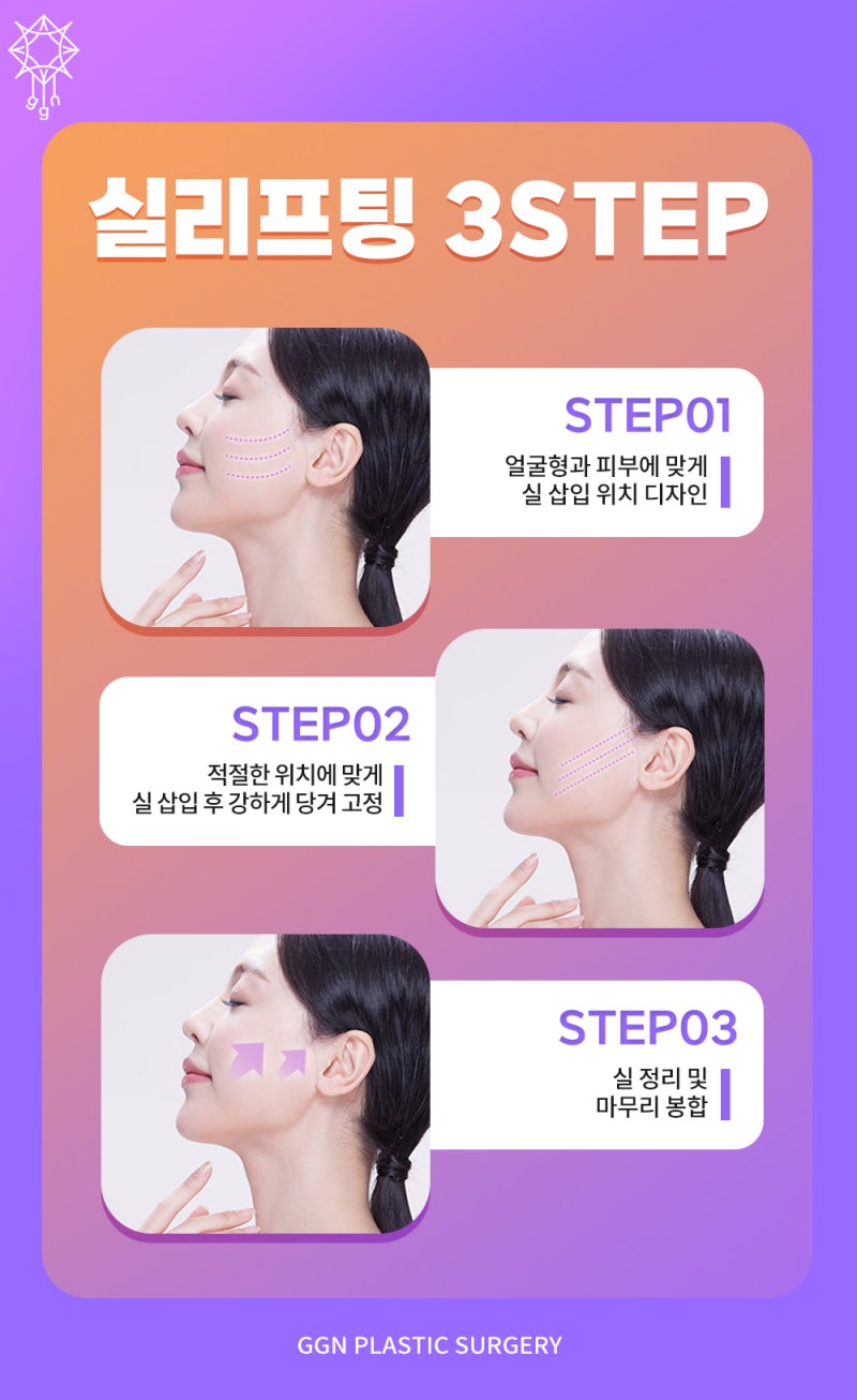 강남 실리프팅 알아보자_꿈꾸는성형외과 사진 9