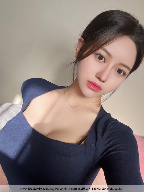 2023 최신 얼굴 성형 트렌드 사진 3