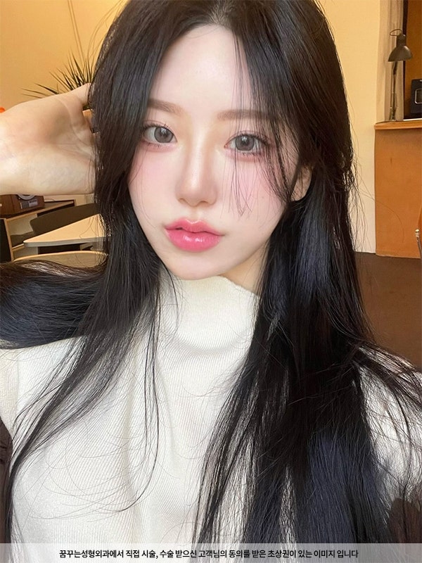 2023 최신 얼굴 성형 트렌드 사진 5