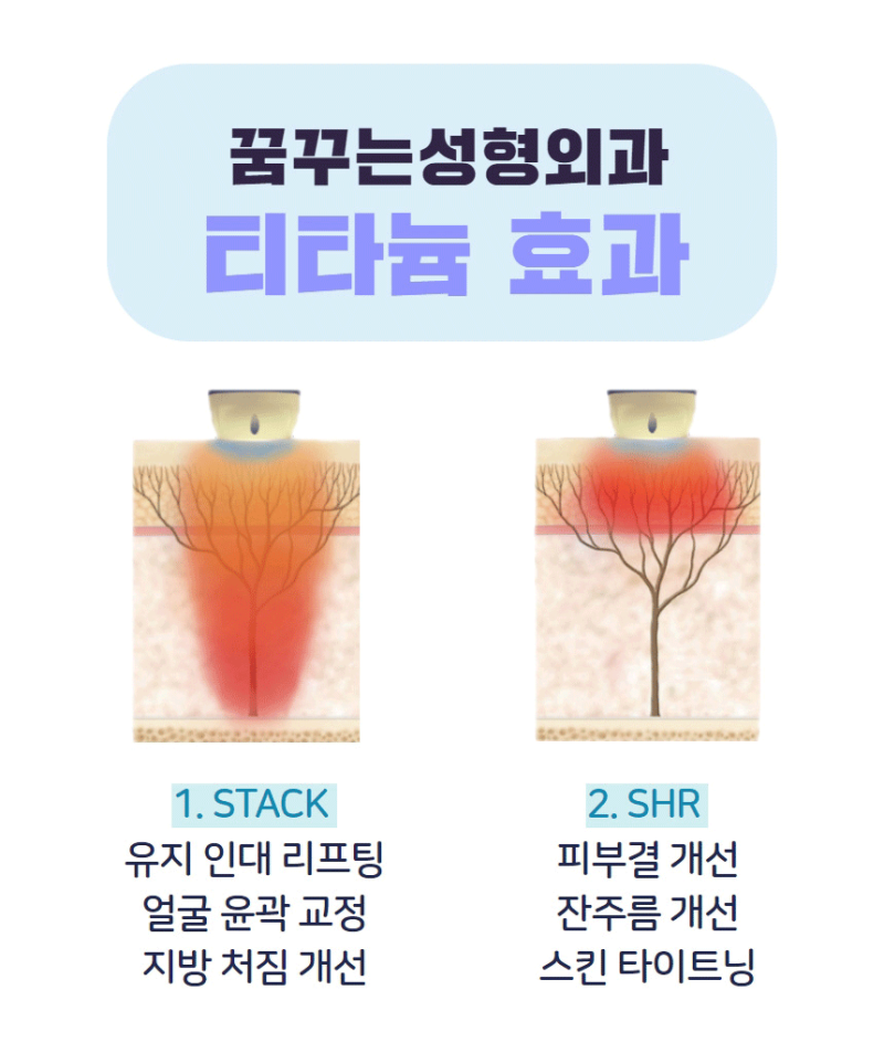 강남 피부관리 티타늄 리프팅 어떤가요? 사진 5