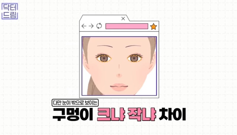 [강남꿈꾸는성형외과] 연예인으로 보는 2023 남자 눈 성형 트렌드 사진 3