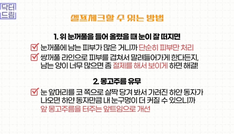 [강남꿈꾸는성형외과] 연예인으로 보는 2023 남자 눈 성형 트렌드 사진 14