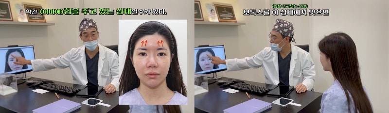 내시경이마거상 동안되는 비결 - 꿈꾸는성형외과 사진 8