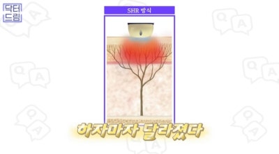 2023결산_ 가장 인기많은 핫한 레이저는? 사진 19