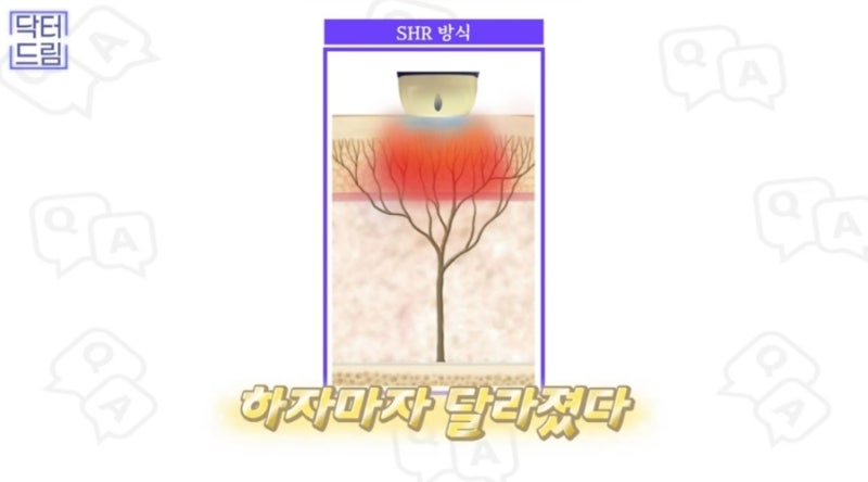 2023결산_ 가장 인기많은 핫한 레이저는? 사진 27