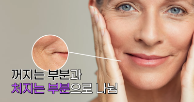 팔자주름 마리오네트주름 입가주름 해결법 사진 6