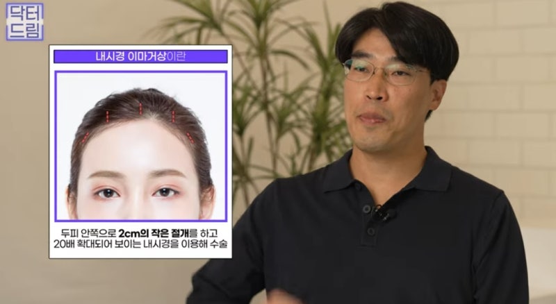 힙한 mz는 다 알고있는 이마리프팅 사진 6