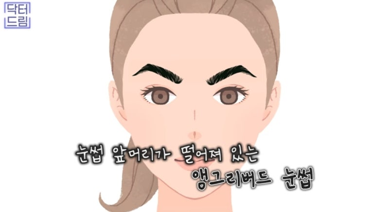 힙한 mz는 다 알고있는 이마리프팅 사진 20