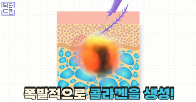 실리프팅 해 본 사람만 알 수 있는 비밀 사진 21
