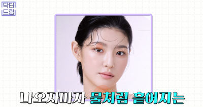 눈꺼풀이 쑥 꺼지고 퀭한 눈위꺼짐 해결법 (지방이식,필러) 사진 28