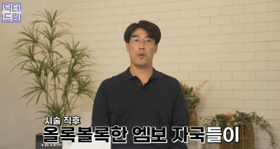 피부링거 스킨부스터 리쥬란힐러 A to Z 사진 29