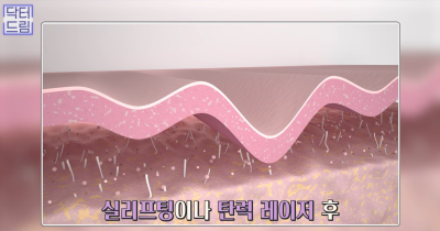[강남역 성형외과] 켈로이드라서 쌍꺼풀 수술 고민하고 있다면 보세요. 흉터에 관한 모든걸 알려드려요