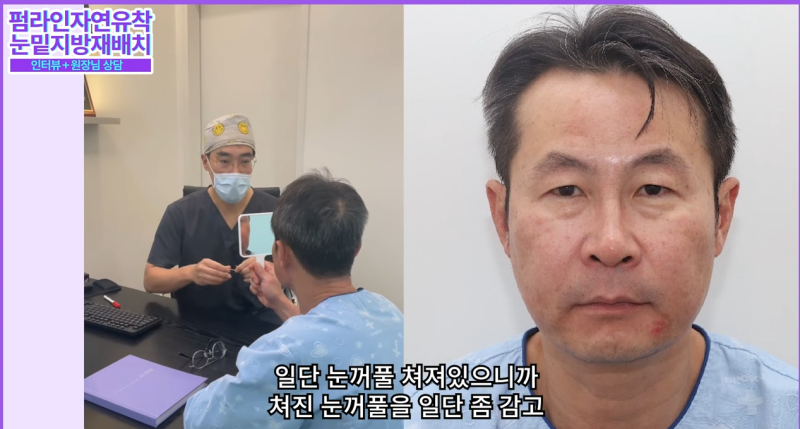 50대 중년 남자 노화고민 / 안티에이징 수술 솔직후기 사진 7