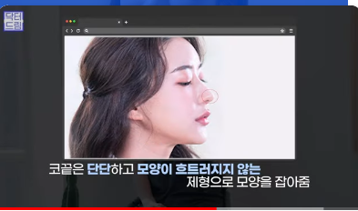 [강남역 성형외과] 이거 모르면 보톡스, 필러 맞았다가 후회합니다 사진 36