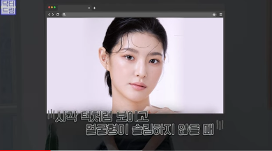 [강남역 성형외과] 이거 모르면 보톡스, 필러 맞았다가 후회합니다 사진 11