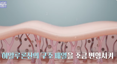 [강남역 성형외과] 이거 모르면 보톡스, 필러 맞았다가 후회합니다 사진 45