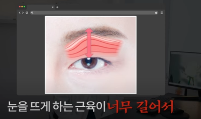 쌍꺼풀하면 대박나는 4가지 유형 사진 18
