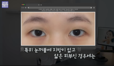 쌍꺼풀하면 대박나는 4가지 유형 사진 22