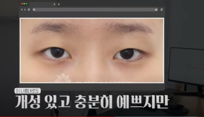 쌍꺼풀하면 대박나는 4가지 유형 사진 27