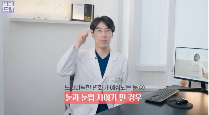 쌍꺼풀하면 대박나는 4가지 유형 사진 21