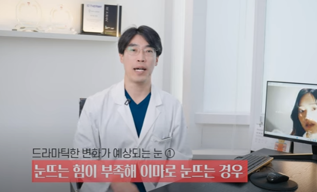쌍꺼풀하면 대박나는 4가지 유형 사진 10