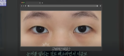 [강남역성형외과] 성형외과 처음갈 때 망하고 싶지 않으면 보세요 (상담꿀팁, 병원선택기준) 사진 24