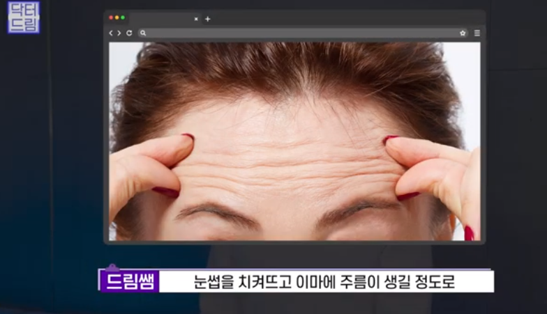 [강남역 성형외과] 깊어져만 가는 이마주름이 고민이라면 이것을 하세요 사진 9