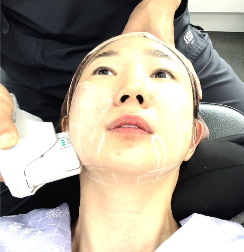 울쎄라 체험기: 피부 리프팅의 새로운 시작 사진 4