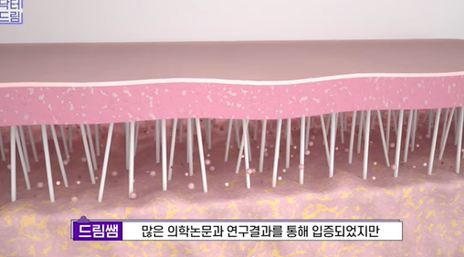 [강남역 성형외과] 닥터드림이 알려주는 내 얼굴에 딱 맞는 레이저 고르기 /레이저 오래가는 법 사진 28