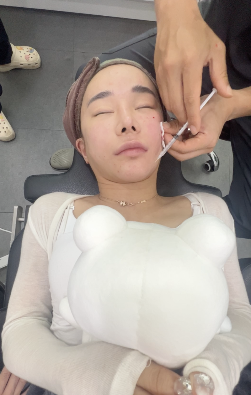 [강남역성형외과] 필러 시술, 어디서 받을지 고민 중이신가요? 사진 3