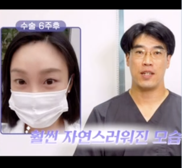 [강남역 성형외과] 이마주름, 콧등주름, 처진 눈꺼풀을 한 번에 해결하는 최적의 방법 사진 2